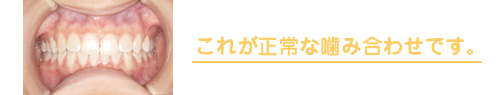 これが正常な噛み合わせです。